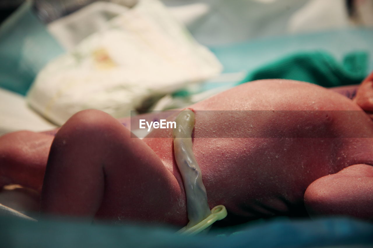 Close-up of newborn baby with umbilical cord at hospital