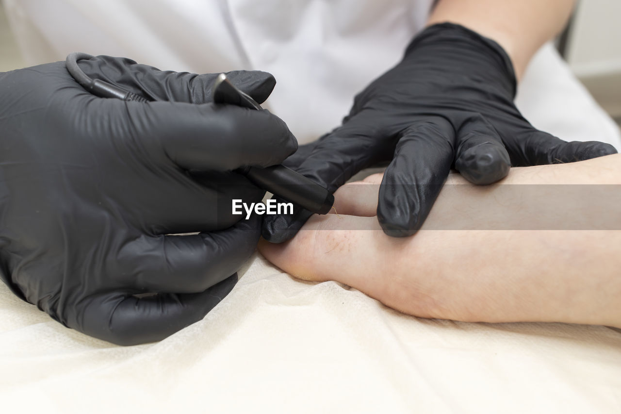 Unrecognizable dermatologist doing hair removal electrolysis procedure on woman's toes, foot