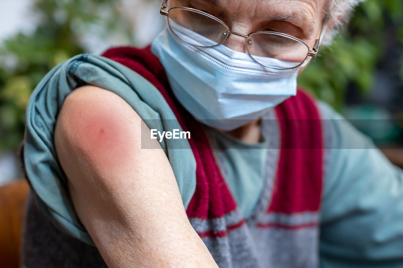 Close-up of senior woman swollen arm