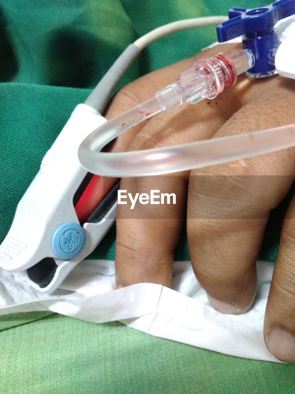 Cropped image of person hand with iv drip in hospital