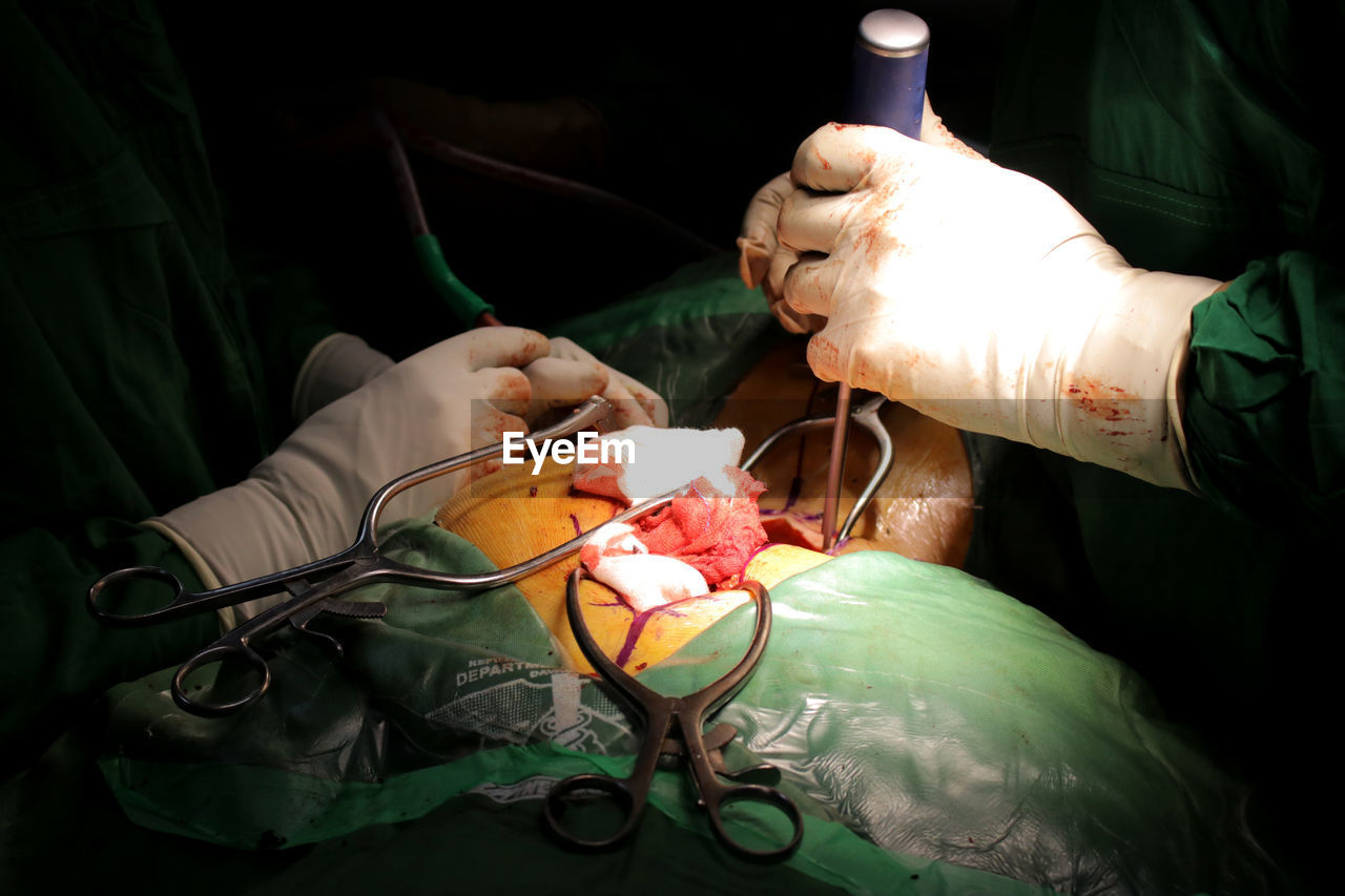 Cropped image of surgeons operating patient in emergency room