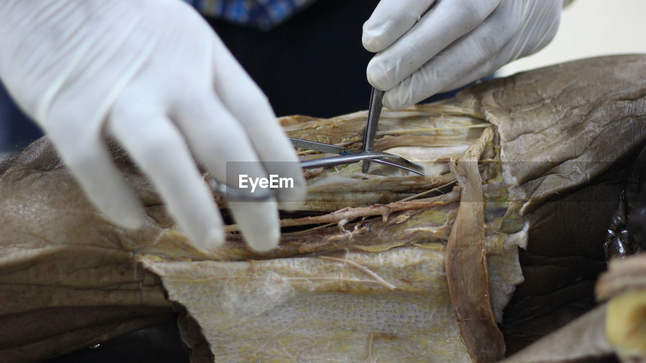 Cropped hands of doctor doing surgery in hospital