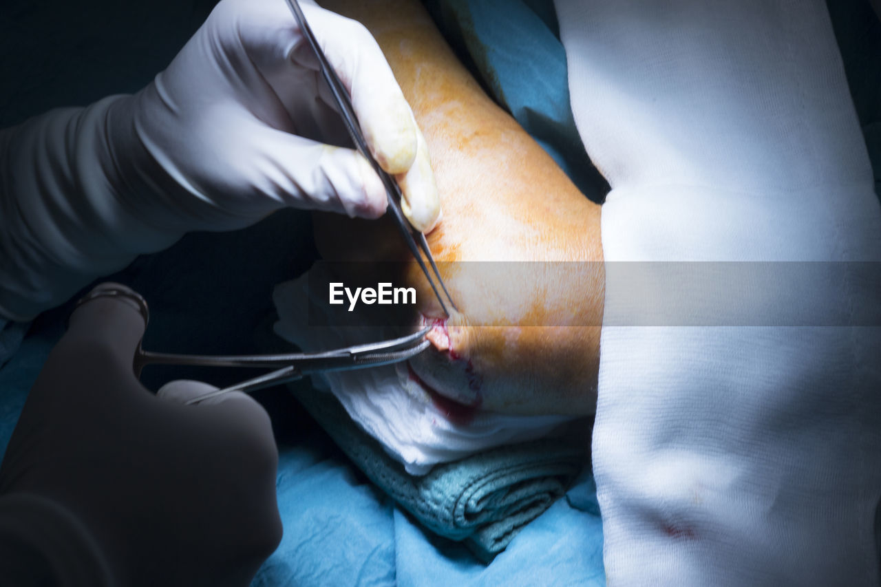 Cropped hands of surgeons doing knee surgery in hospital