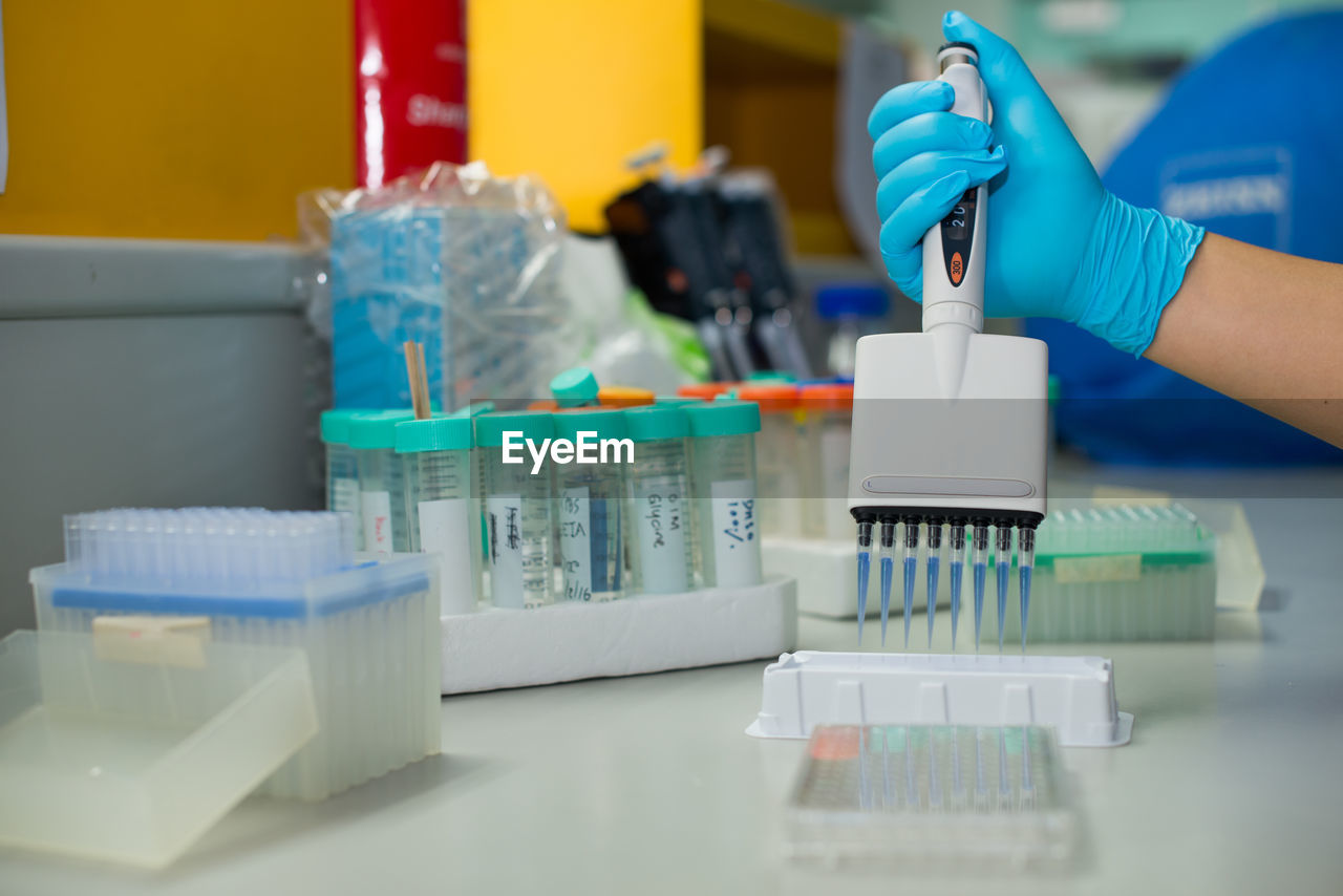 Cropped hand of doctor doing research in laboratory