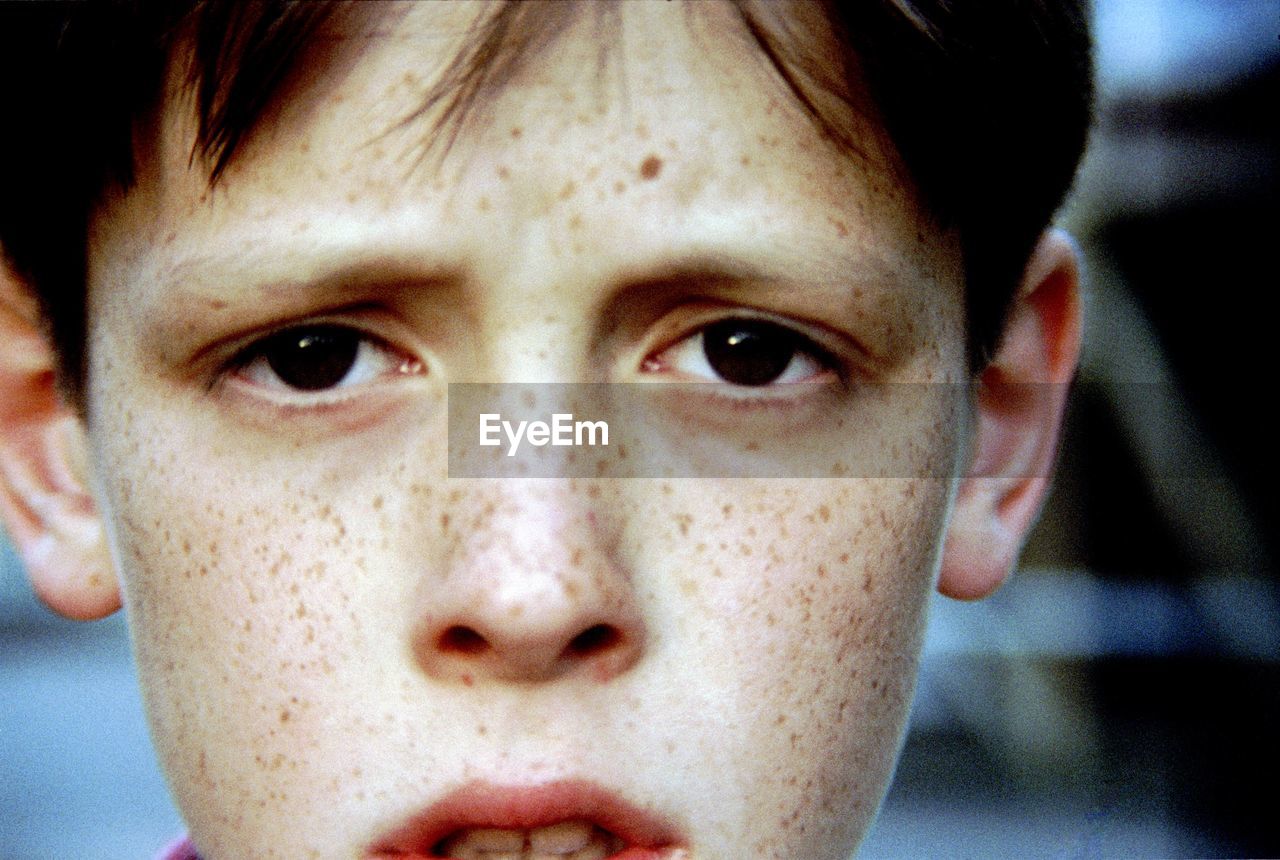 Close-up portrait of boy with freckles