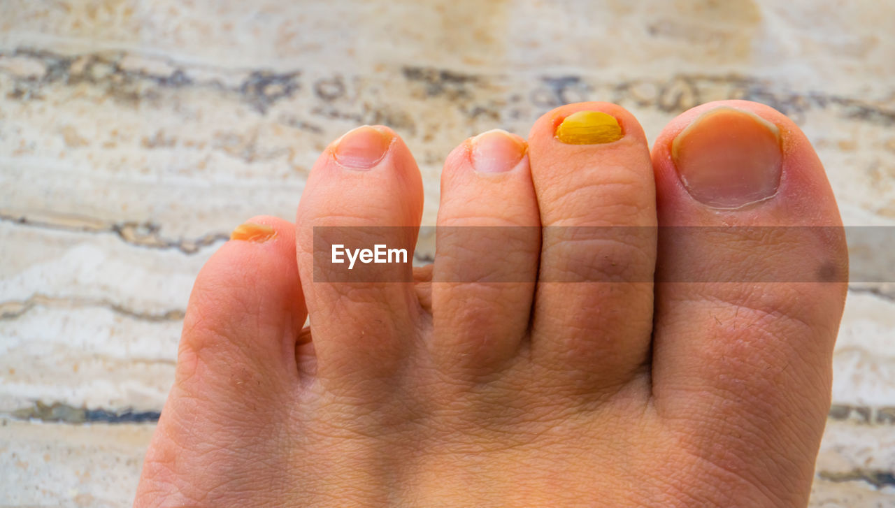 human leg, toe, human foot, finger, limb, nail, close-up, toenail, nail polish, one person, barefoot, adult, hand, women, fingernail, relaxation, low section, yellow, lifestyles, personal perspective, leisure activity, human mouth, nature