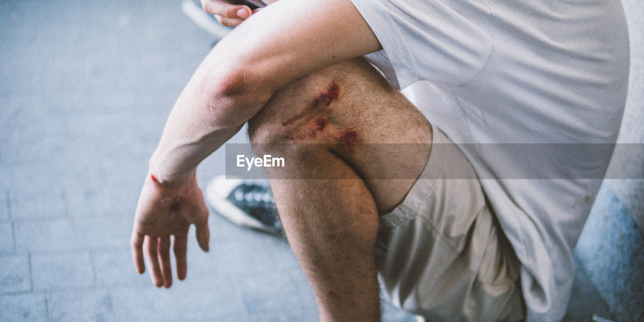 Low section of injured man crouching outdoors