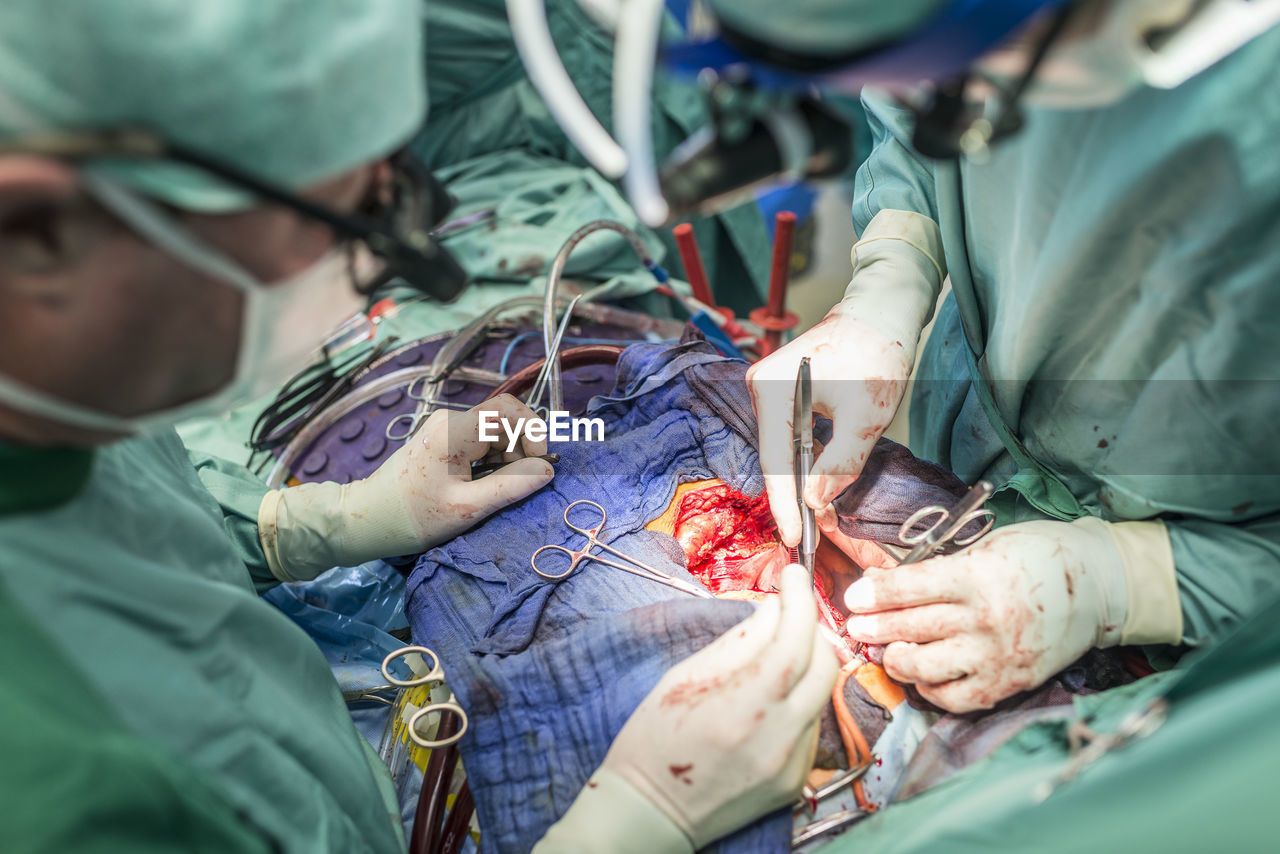 Surgeons executing heart bypass surgery