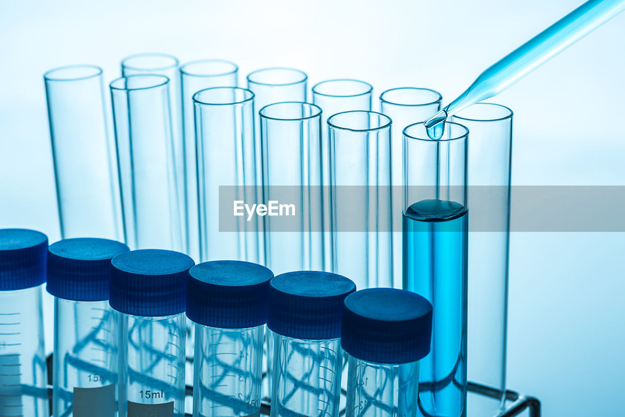 Close-up of pipette over test tube with chemical at laboratory