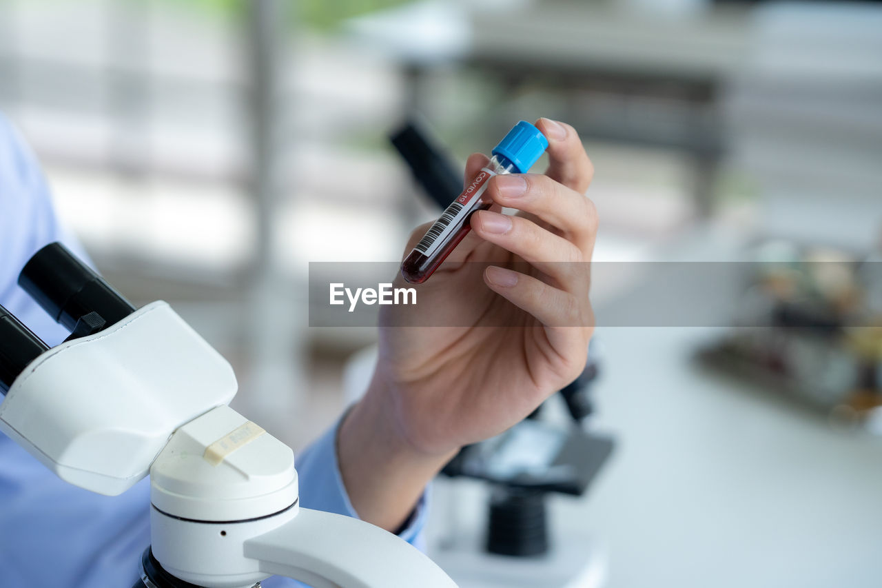 cropped hand of doctor examining patient in laboratory