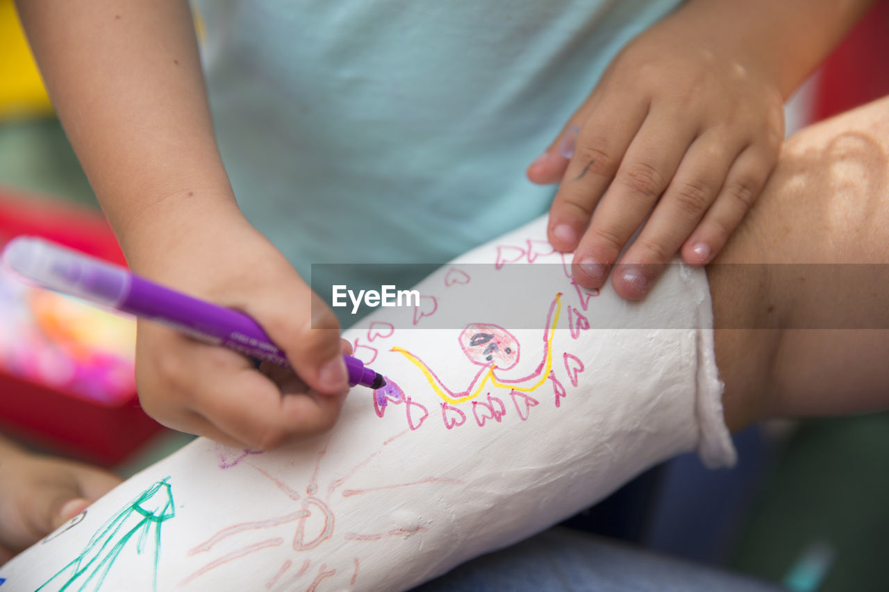 Little girls painting her mother's plaster arm