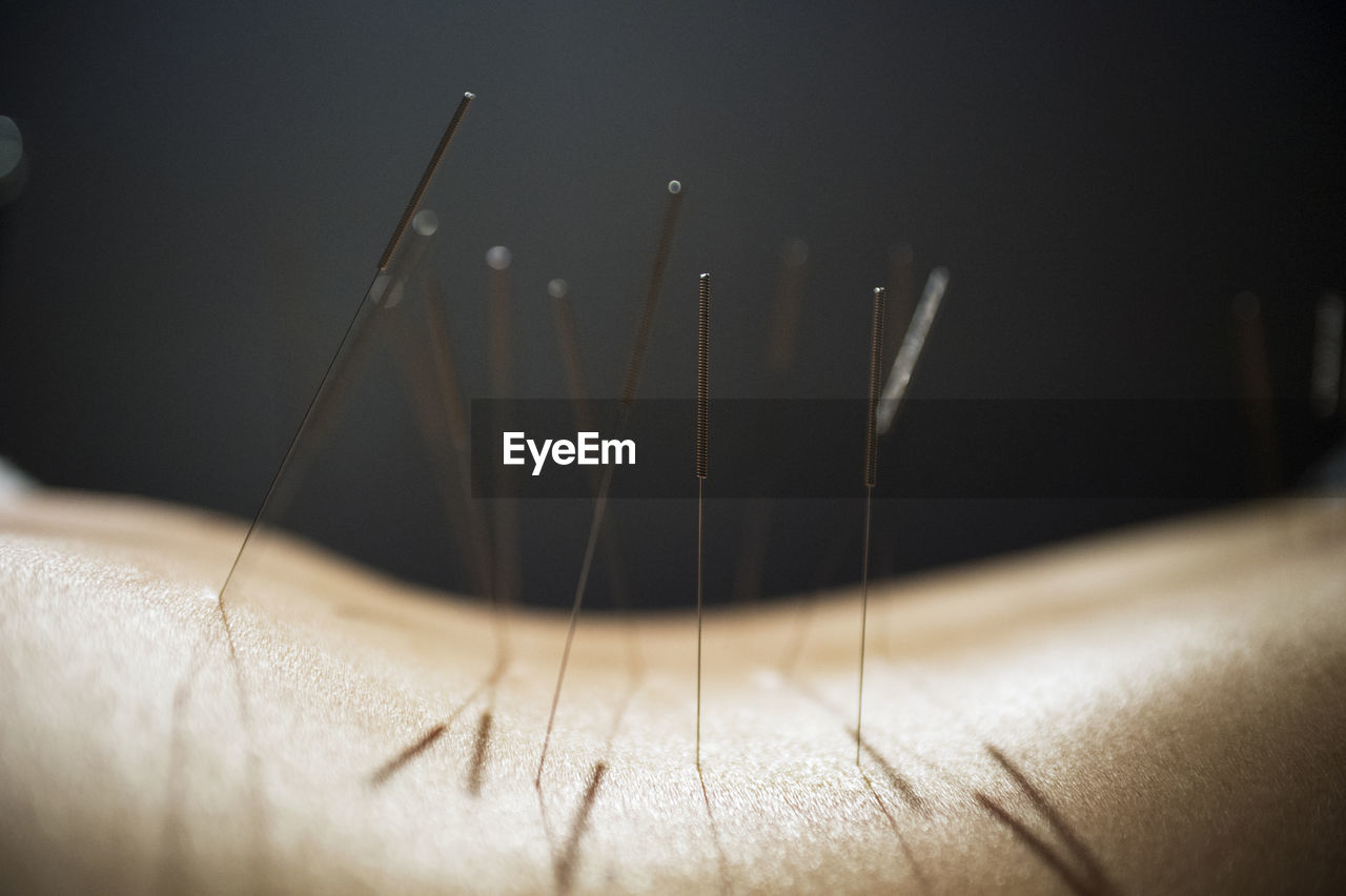 Midsection of person with acupuncture needles on back against black background