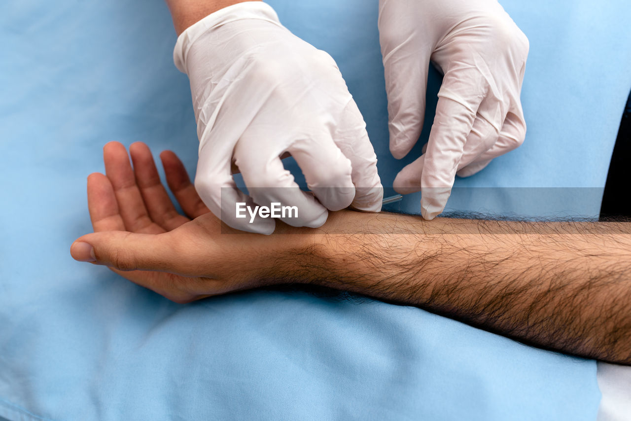 Midsection of doctor injecting acupuncture needle to patient