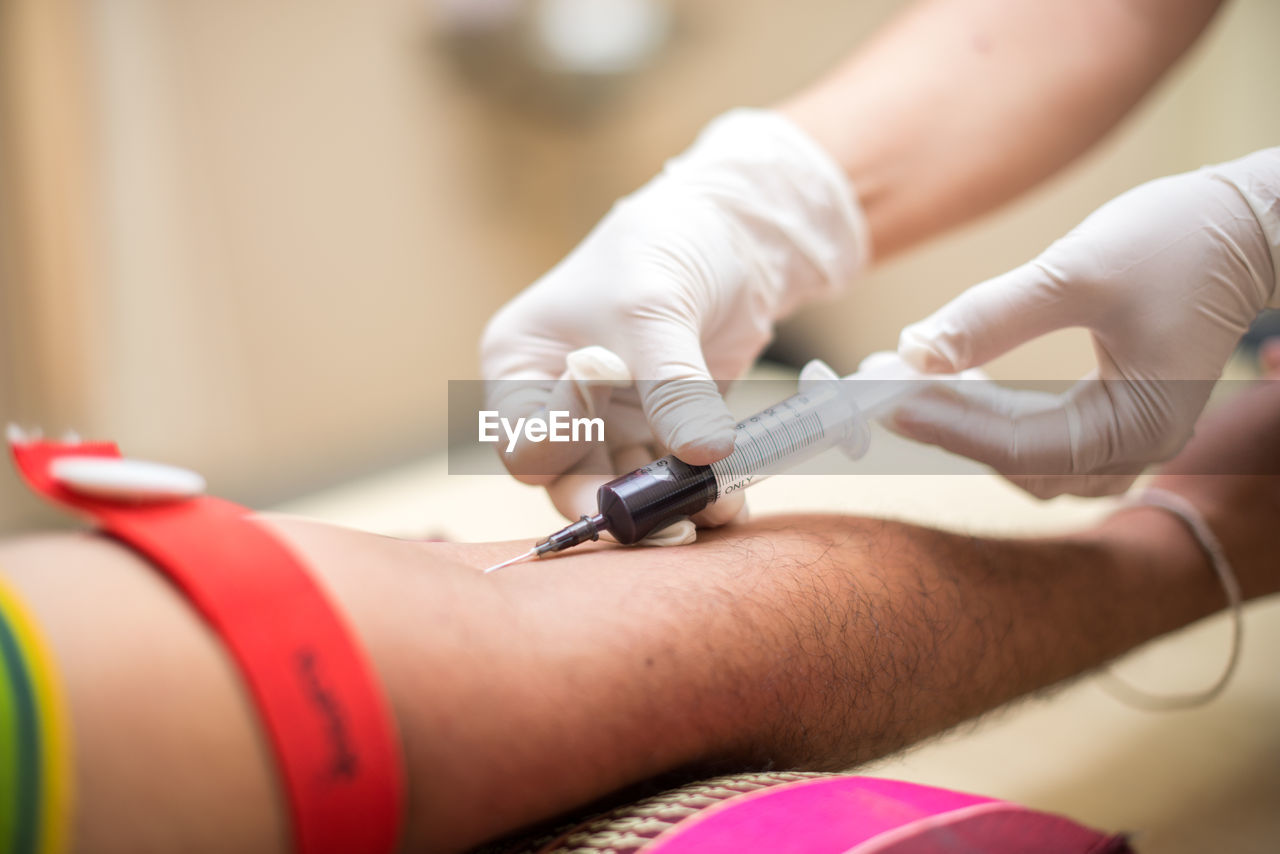 Cropped hands of doctor removing blood sample from patient arm