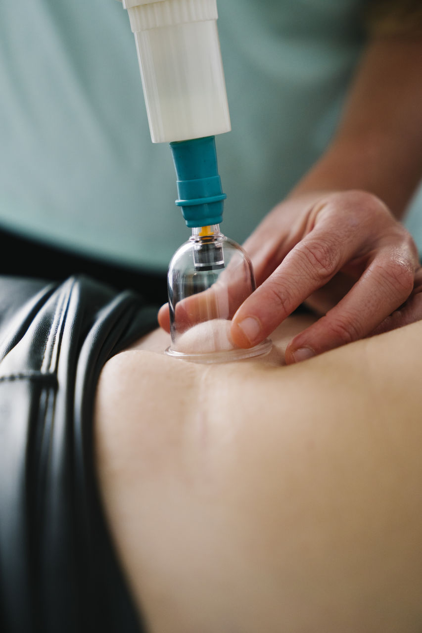 Midwife vacuum cupping on patient's abdomen