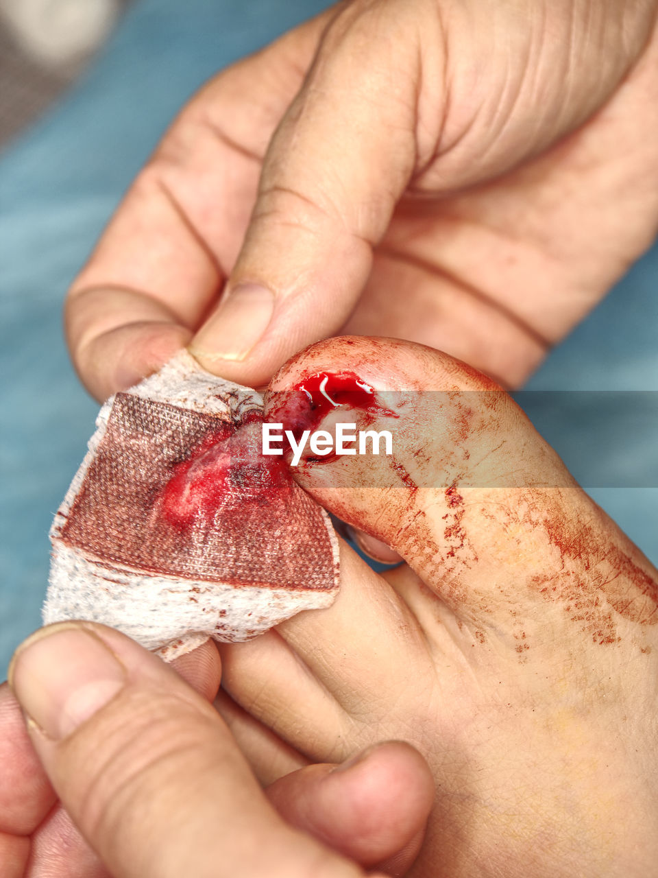 hand, blood, wound, physical injury, skin, pain, finger, close-up, healthcare and medicine, human mouth, one person, adult, red, holding, limb, flesh, lip, human blood, accidents and disasters, hospital, men, arm