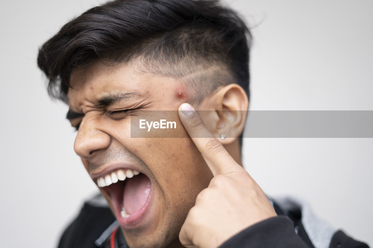 Portrait of a young man is use to touch pimples on the face standing on a white background.