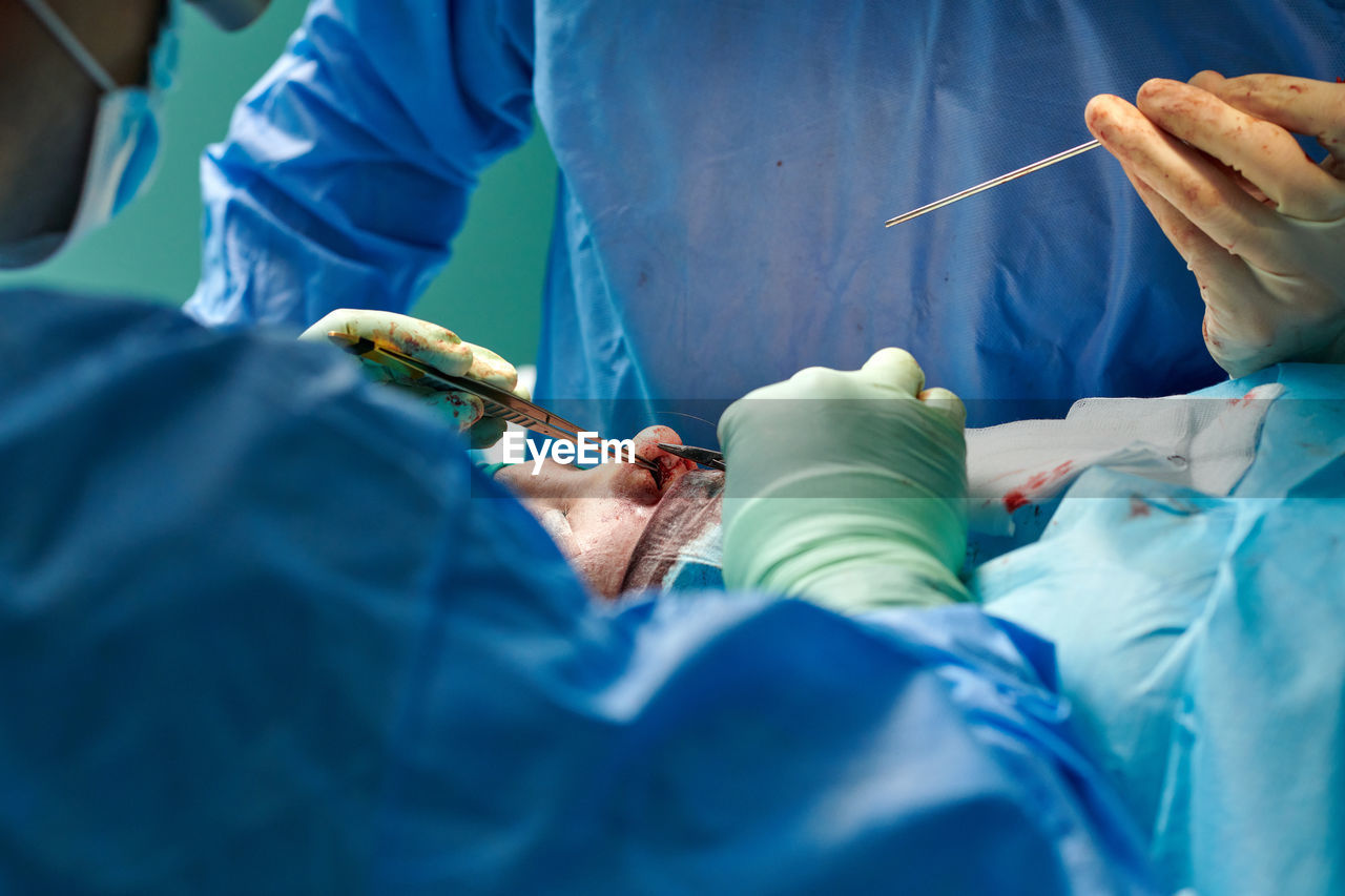 Crop unrecognizable plastic surgeons in gowns and gloves using tweezers while performing rhinoplasty operation in contemporary clinic
