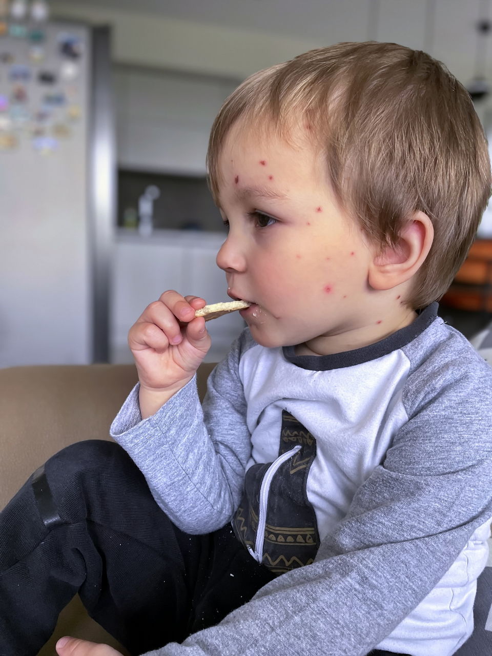 Portrait of little toddler with chickenpox eating cookie