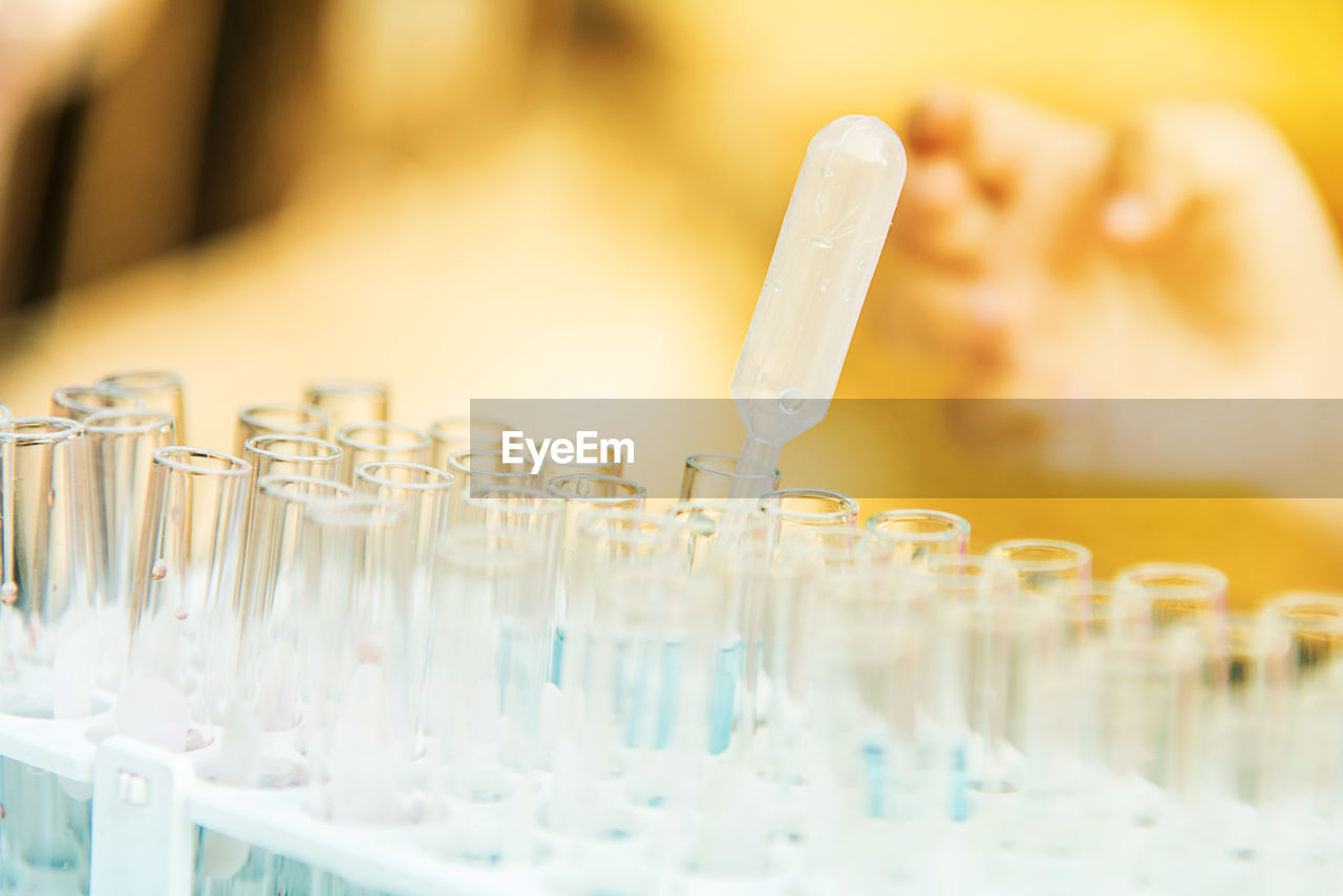 Cropped hand of person examining test tubes in rack at medical laboratory