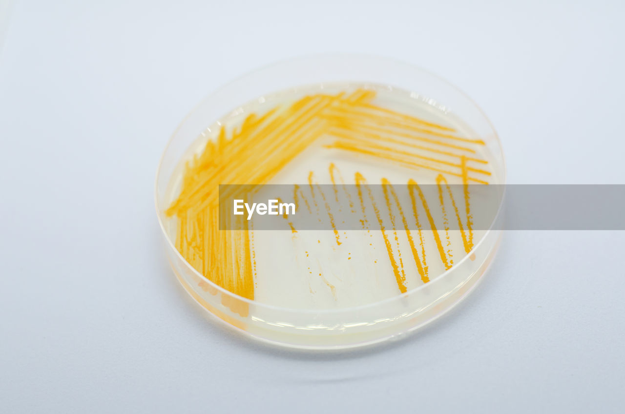 Orange colonies of actinomyces bacteria on agar plate