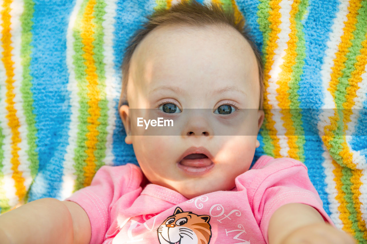 Close-up portrait of cute baby with down syndrome