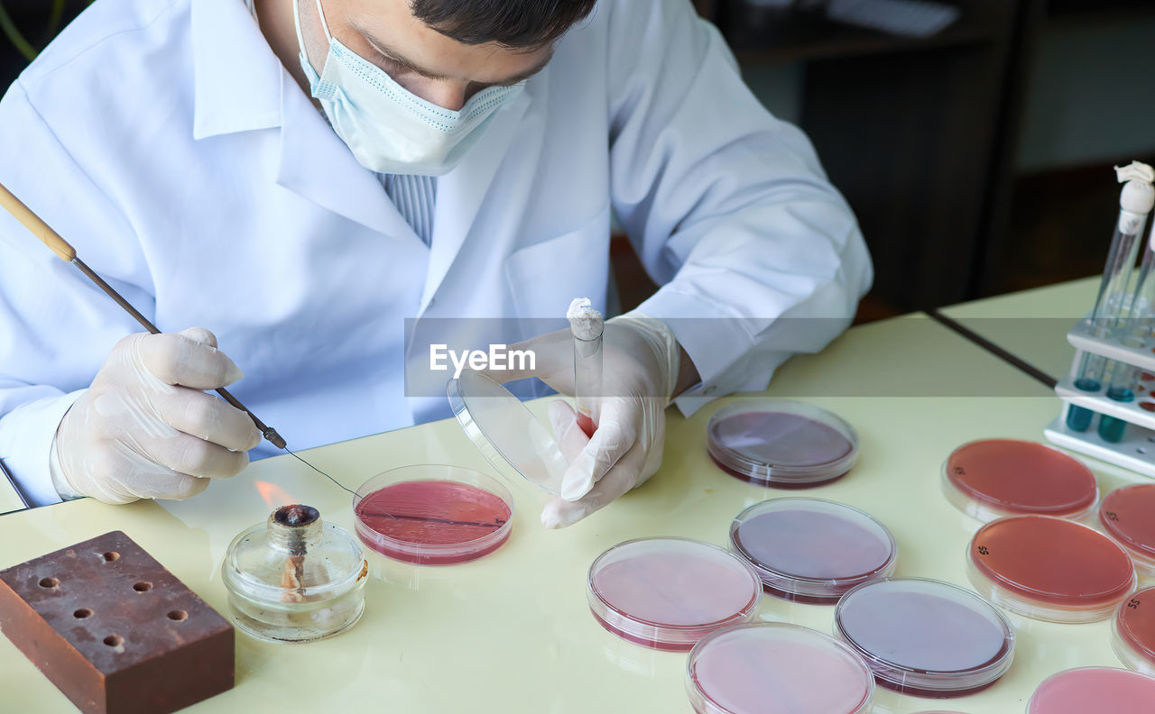 The laboratory researcher makes bacteriological inoculation in a petri dish