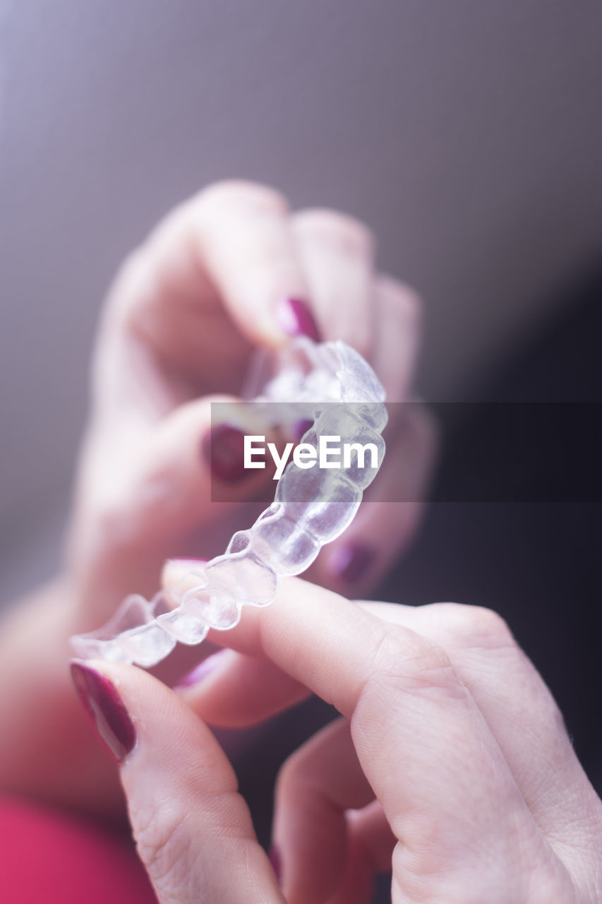 Close-up of hand holding dental aligner