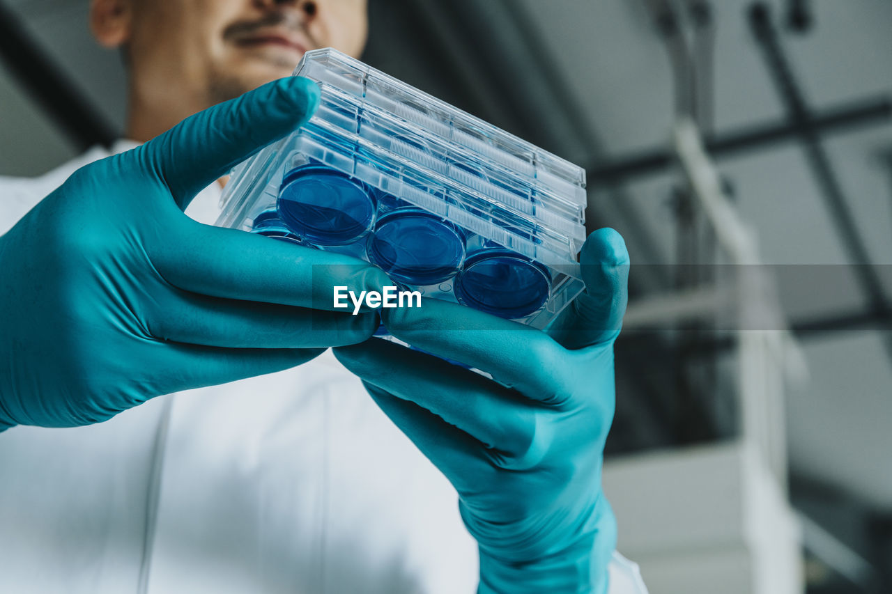 Scientist holding petri dish tray while standing at laboratory