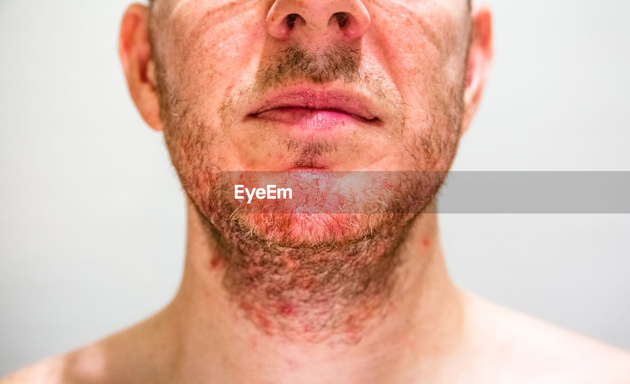 Midsection of man with beard infection against gray background