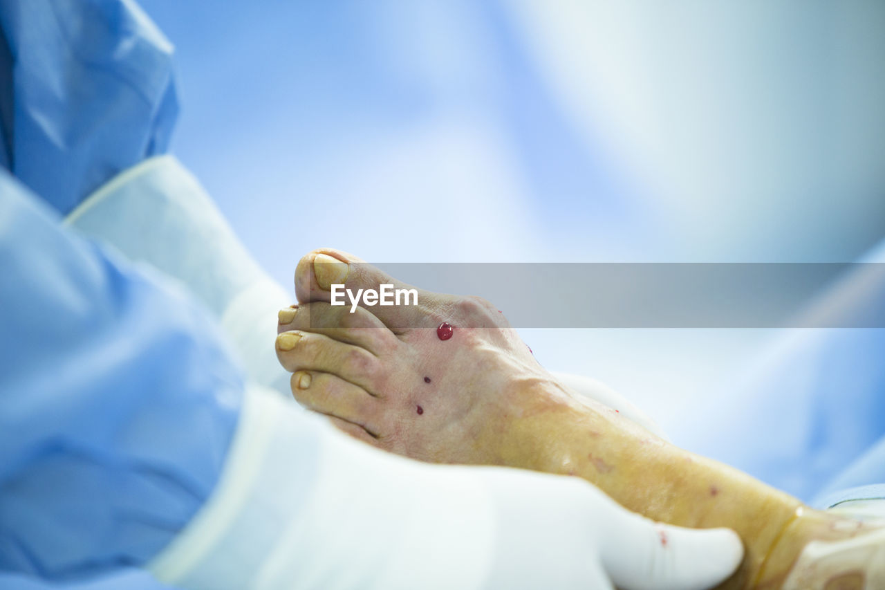 Cropped image of doctor operating patient in hospital