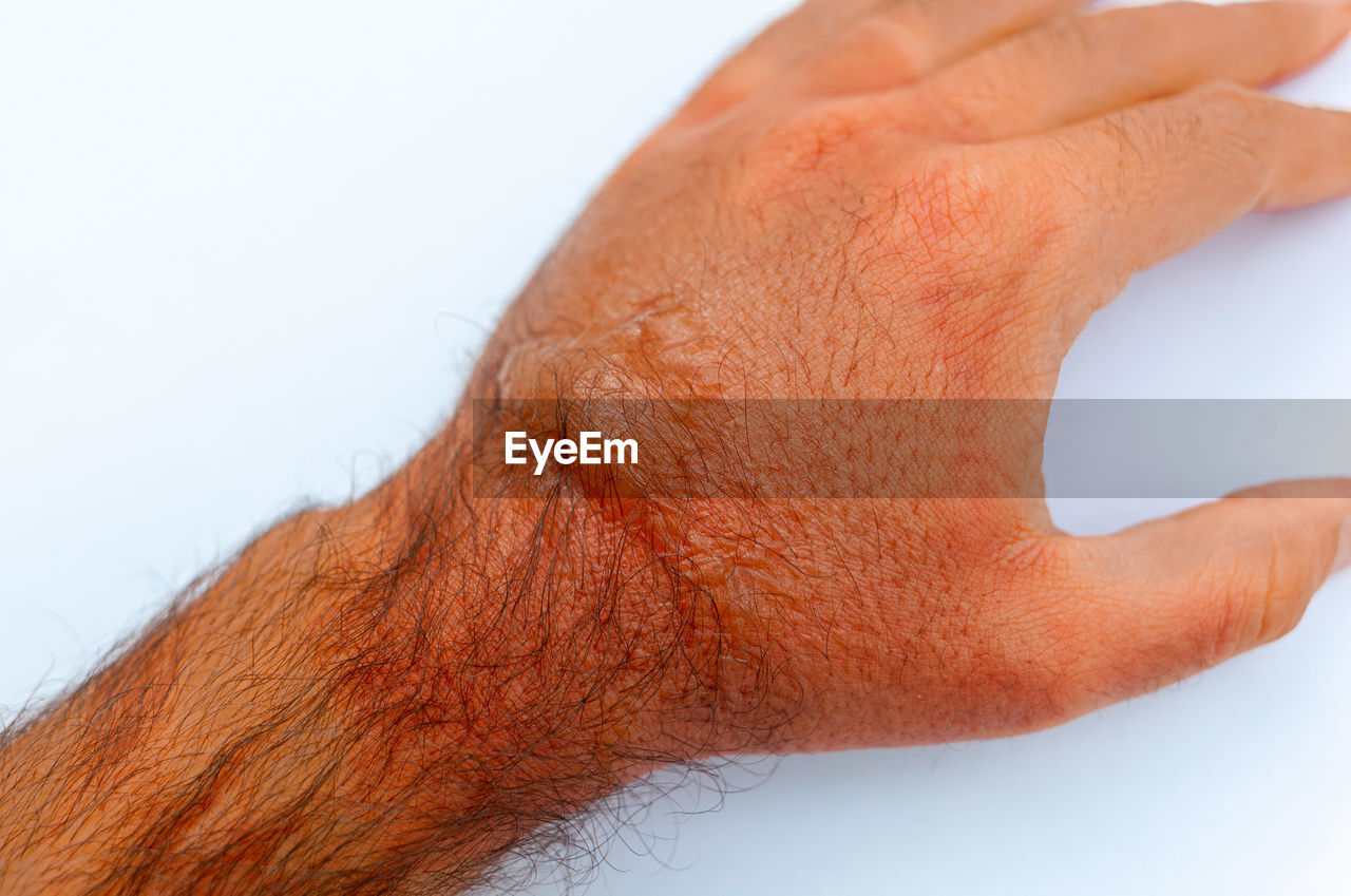 hand, nose, finger, skin, close-up, studio shot, arm, one person, white background, adult, human skin, human head, healthcare and medicine, cut out, limb