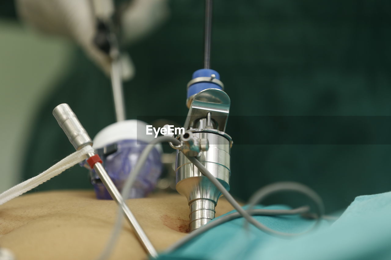 CLOSE-UP OF HUMAN HAND ON FINGER