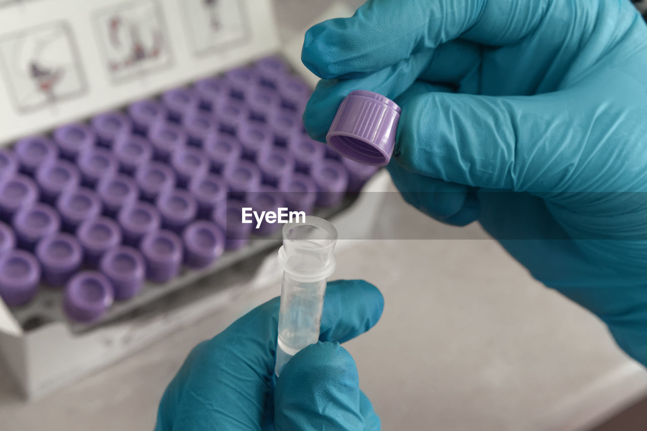 Hand of scientist in blue gloves with blood test tube. medical laboratory testing, analysis 