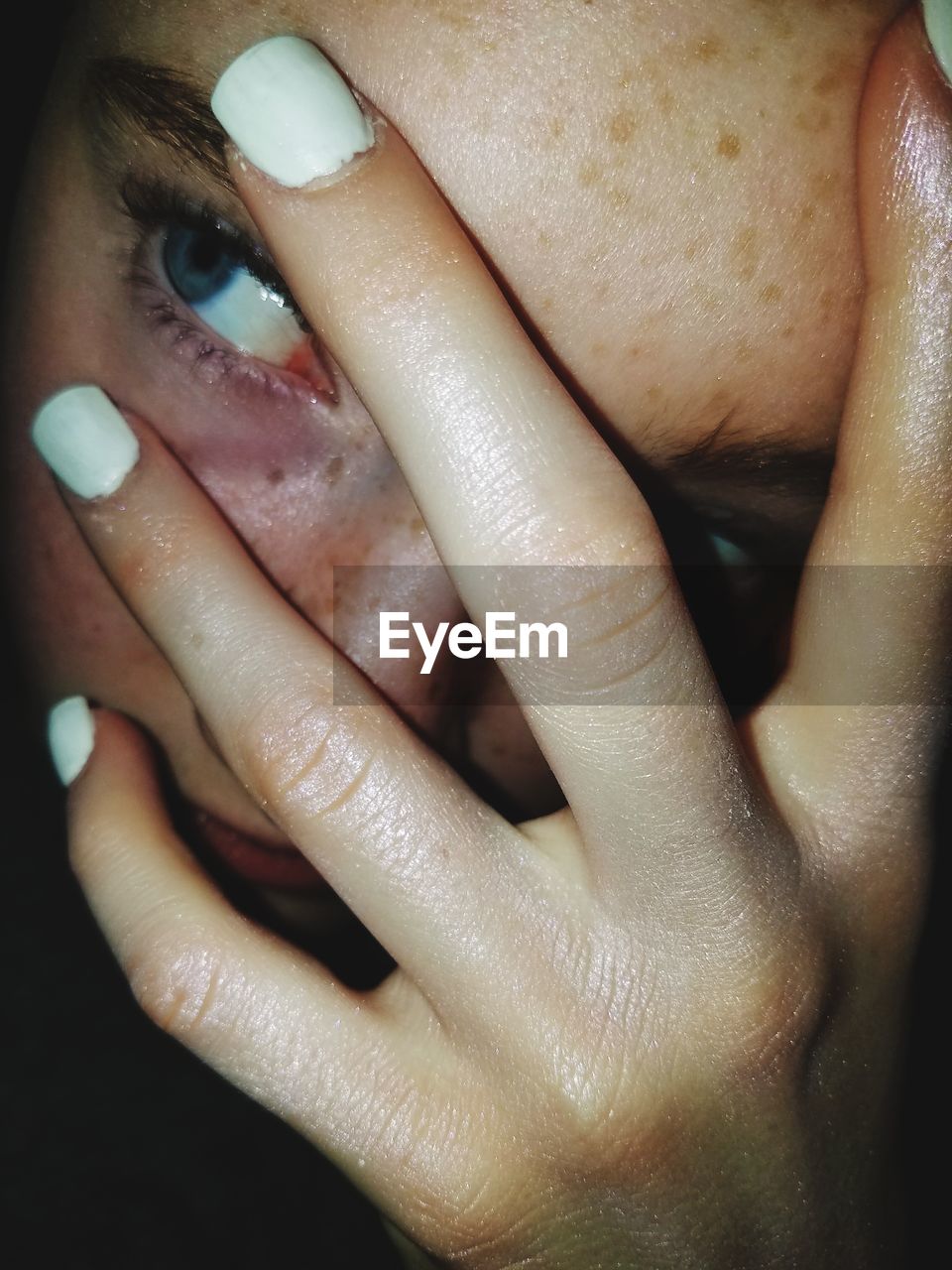 Close-up of young woman hiding face with hands