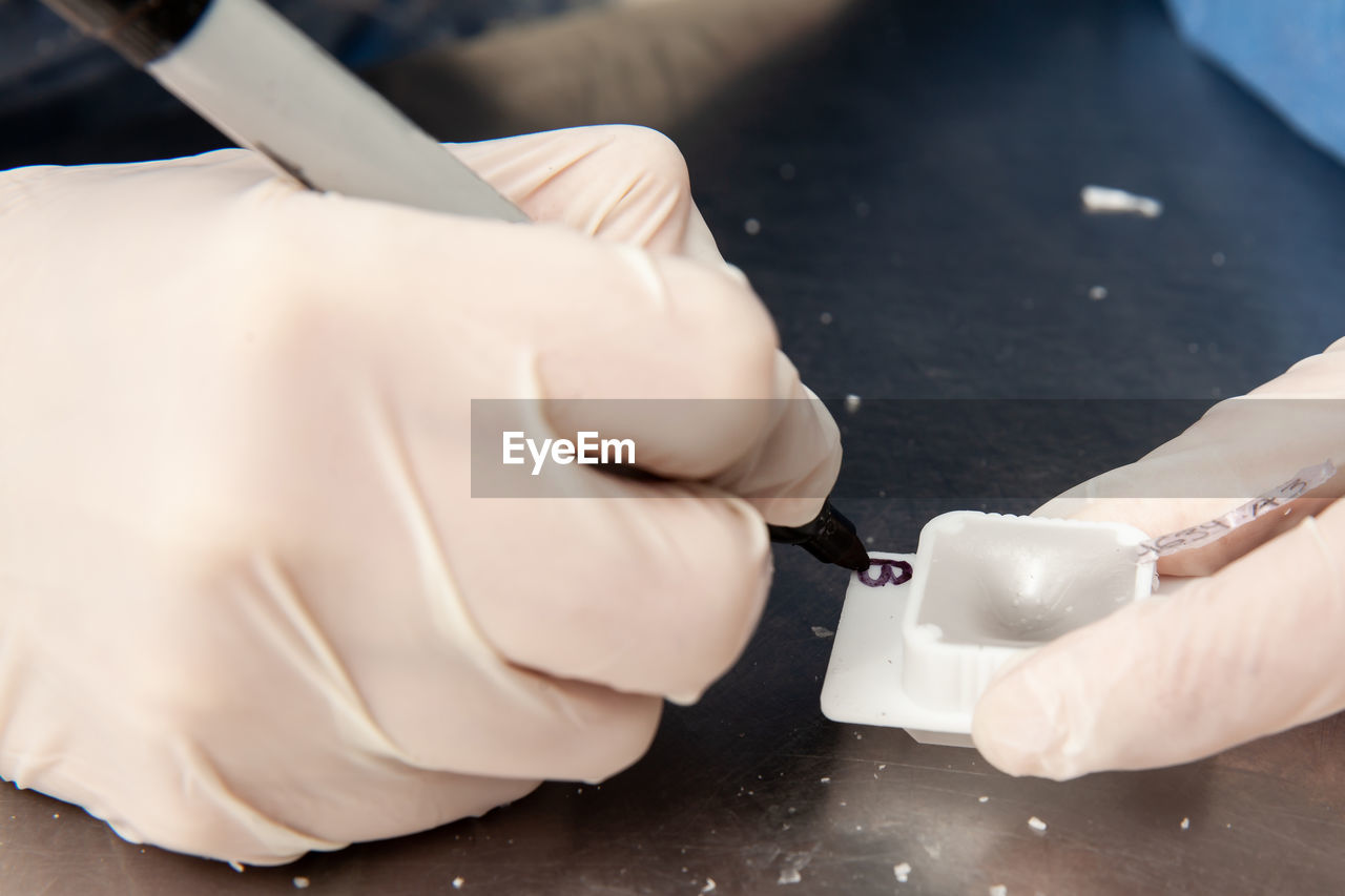 Scientist preparing paraffin blocks containing biopsy tissue for sectioning. pathology laboratory. 