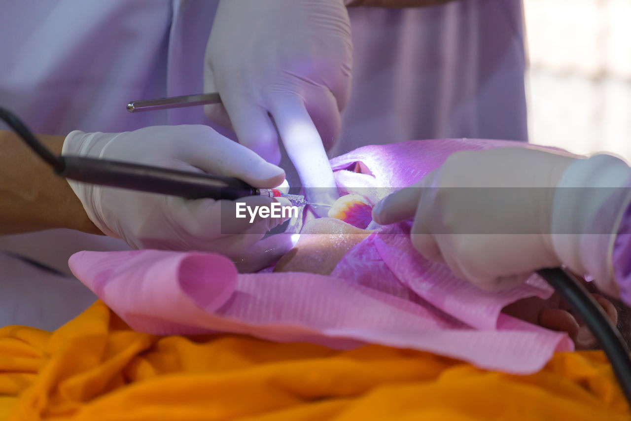 Cropped image of dentist examining patient teeth