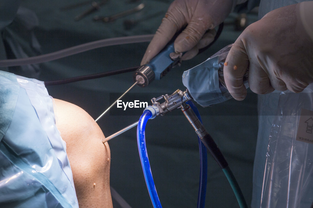 Midsection of doctor performing operation on patient knee in hospital