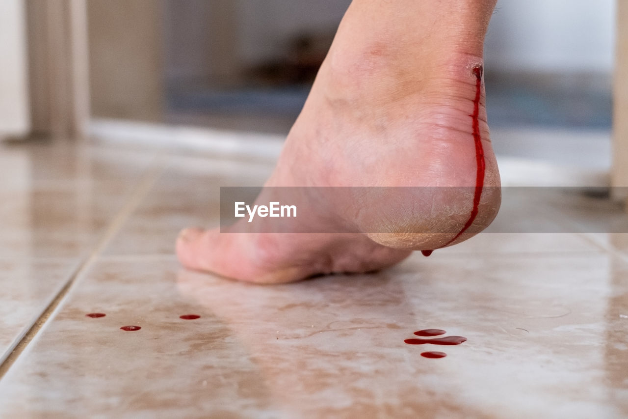 human leg, one person, limb, flooring, indoors, adult, floor, barefoot, human limb, hand, low section, skin, human foot, toe, close-up, blood, arm, red, physical injury, wood, pink, heel