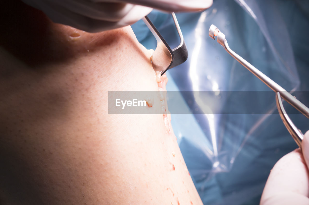 Cropped hands of surgeons doing knee surgery in hospital