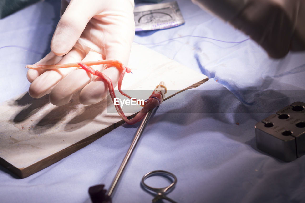 Cropped hand of doctor stitching human body part