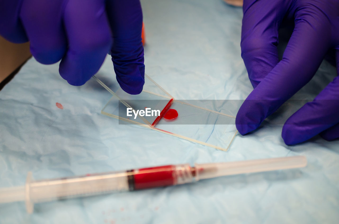 Cropped image of doctor testing blood