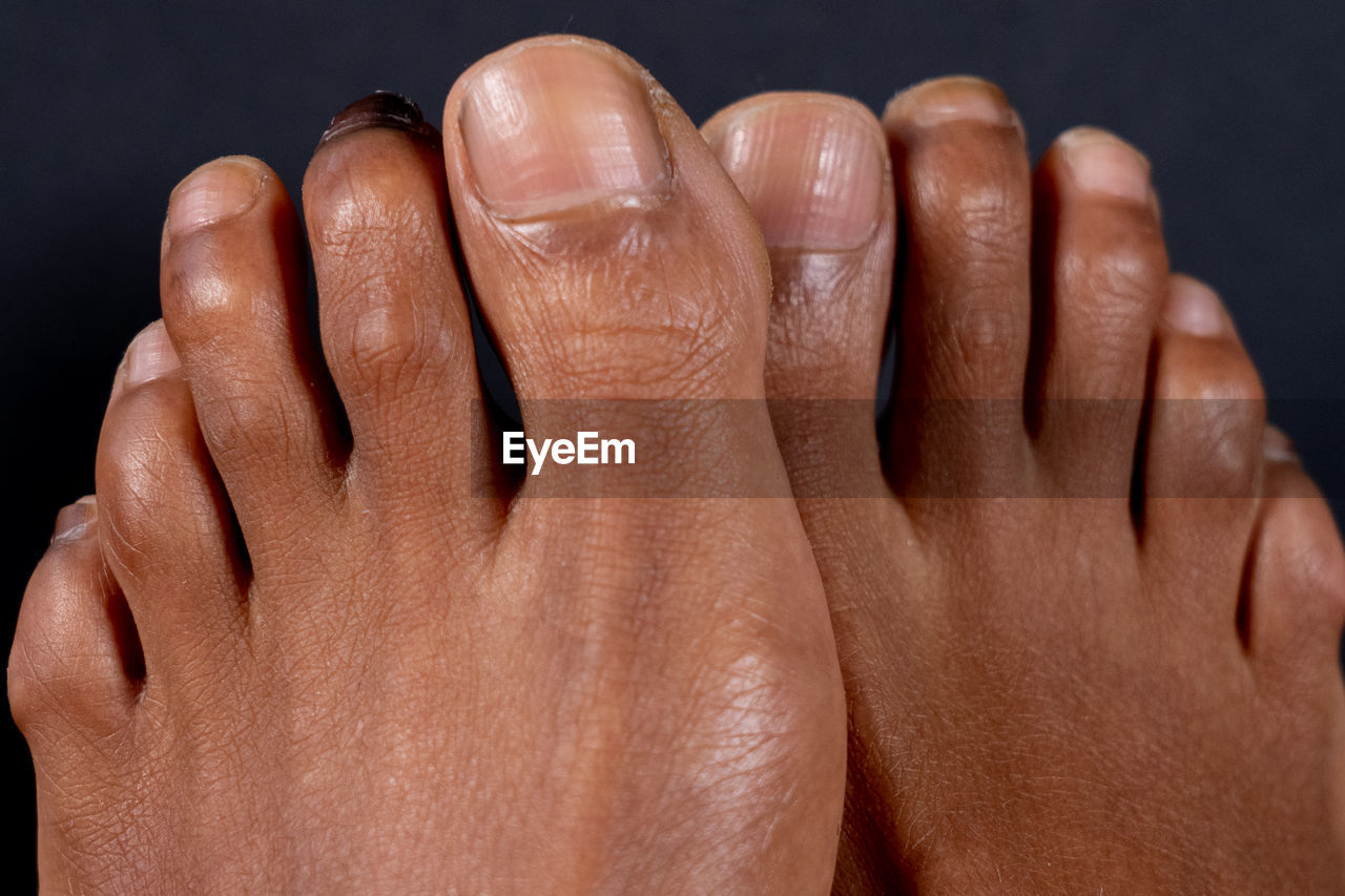 CLOSE-UP OF HUMAN HAND