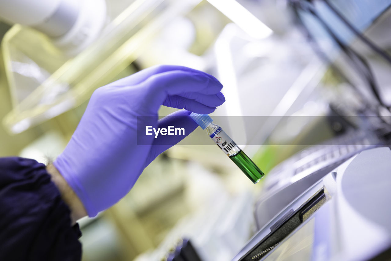 Male doctor's hand wearing a medial glove holding a green vial from a rack in a lab background.