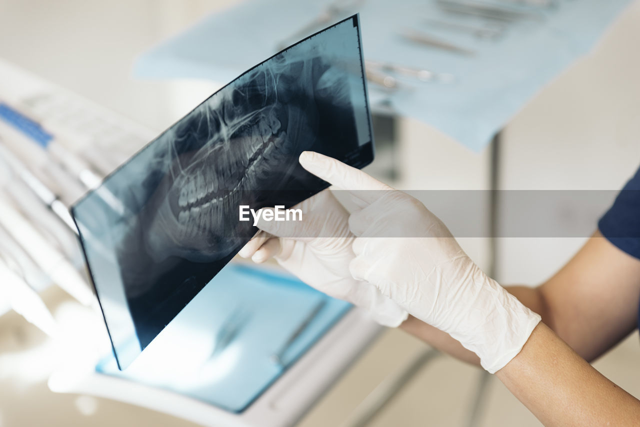 Cropped hands of dentist examining x-ray