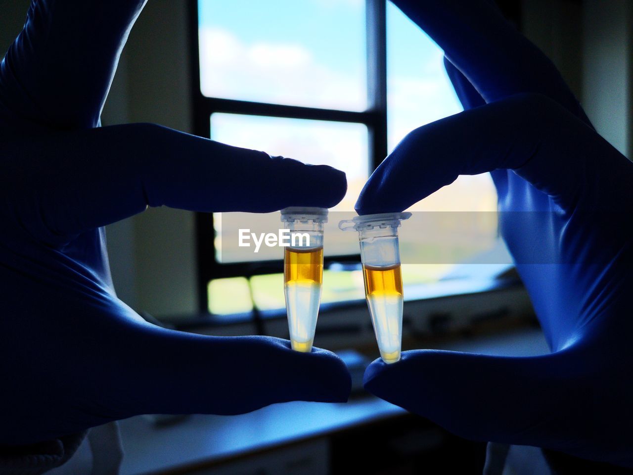 Cropped hands of person holding chemicals in containers