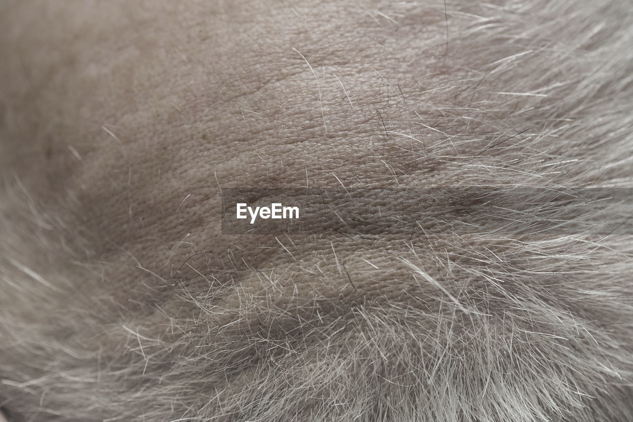 Overhead view of man's scalp