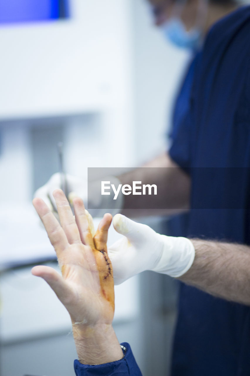 Close-up of surgeon stitching patient hand in operating room