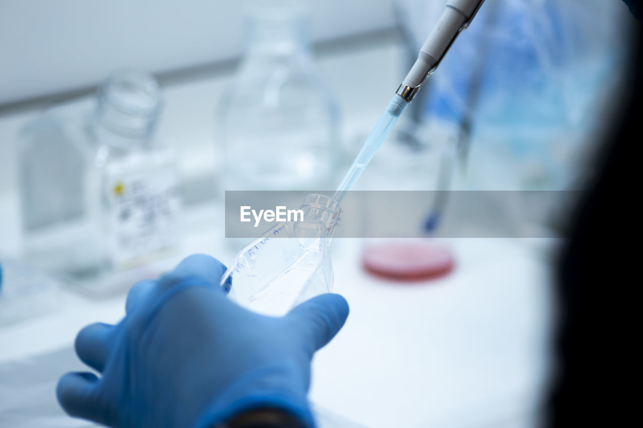 cropped hand of scientist holding dental equipment