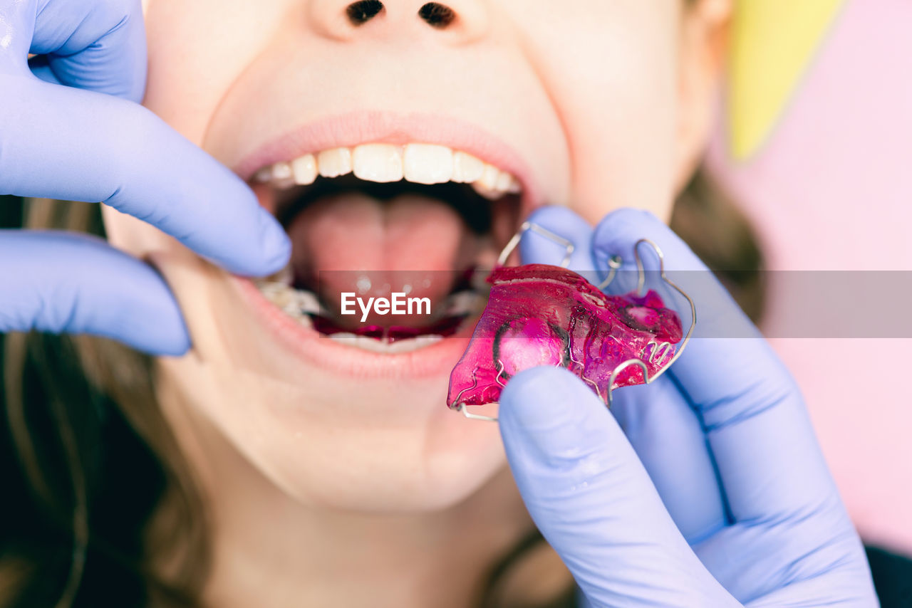 Cropped hands of dentist examining girl teeth